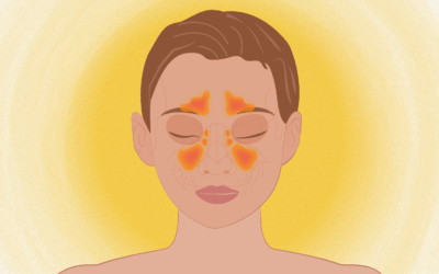 Sinus Headache: Causes, Symptoms, and Relief